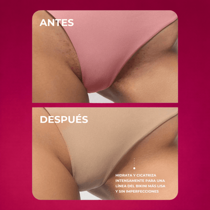 Aceite Truly Para Piel Perfecta - Lisa, Clara y Libre de Olores I ORIGINAL