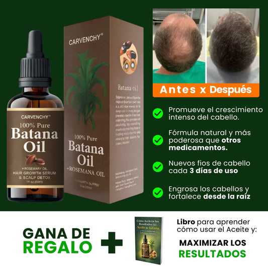 Aceite de Batana – Fortalece, Reactiva y Previene la Caída | Fórmula para Caída Severa
