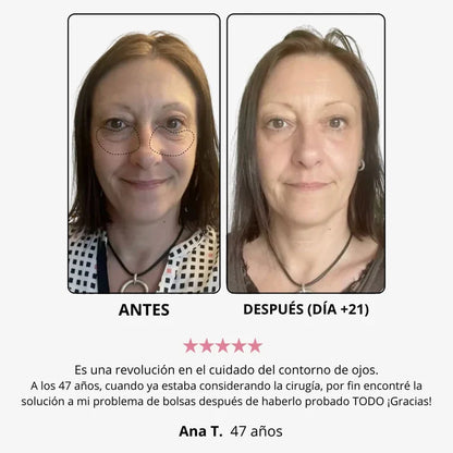 CREMA WOMBEA DE LUZ ROJA PARA EL CONTORNO DE OJOS