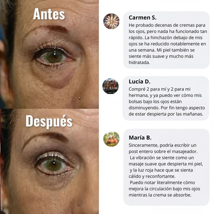 CREMA WOMBEA DE LUZ ROJA PARA EL CONTORNO DE OJOS
