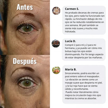 CREMA WOMBEA DE LUZ ROJA PARA EL CONTORNO DE OJOS